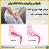 خواص داروی چسبندگی رحم