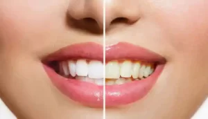شستشوی دندان کاربرد و خواص پودر دندان طب اسلامی
